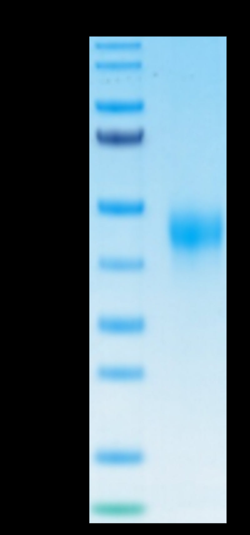 Biotinylated Human TFPI on Tris-Bis PAGE under reduced condition. The purity is greater than 95%.Biotinylated Human TFPI Protein