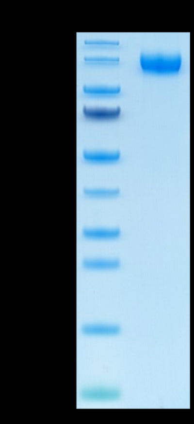 Human VEGF R1 on Tris-Bis PAGE under reduced condition. The purity is greater than 95%.Recombinant Human VEGF R1/FLT-1 Protein, Active