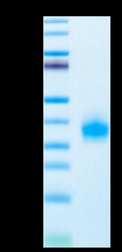 Human ULBP-2 on Tris-Bis PAGE under reduced condition. The purity is greater than 95%.Recombinant Human ULBP-2 Protein, Active
