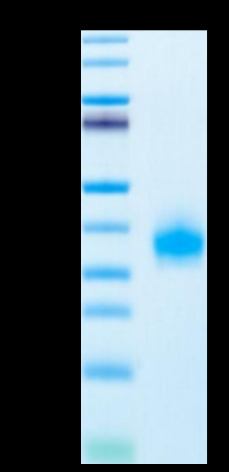 Human ULBP-2 on Tris-Bis PAGE under reduced condition. The purity is greater than 95%.Recombinant Human ULBP-2 Protein, Active