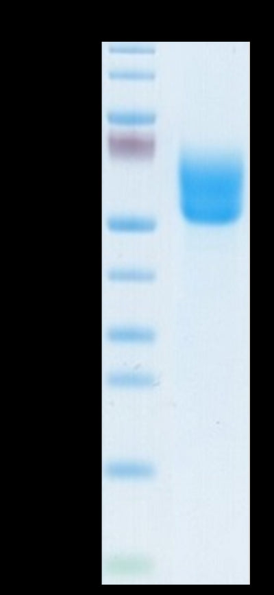 Biotinylated Human DKK3 on Tris-Bis PAGE under reduced conditions. The purity is greater than 95%.Biotinylated Human DKK3 Protein