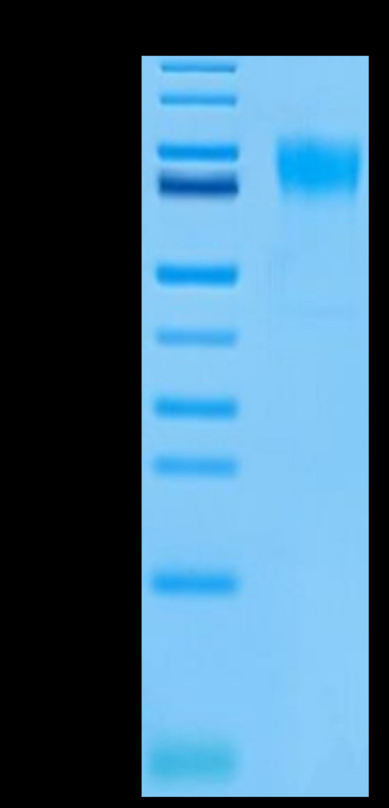 Biotinylated Human FGFR2 alpha (IIIb) on Tris-Bis PAGE under reduced conditions. The purity is greater than 95%.Biotinylated Human FGFR2 alpha (IIIb) Protein, Active