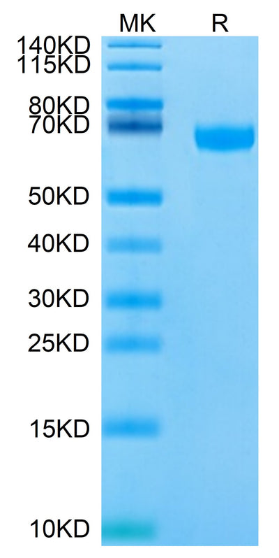 Biotinylated Human/Cynomolgus/Rhesus macaque ROR1 on Tris-Bis PAGE under reduced condition. The purity is greater than 95%.Biotinylated Human/Cynomolgus/Rhesus macaque ROR1 Protein, Active