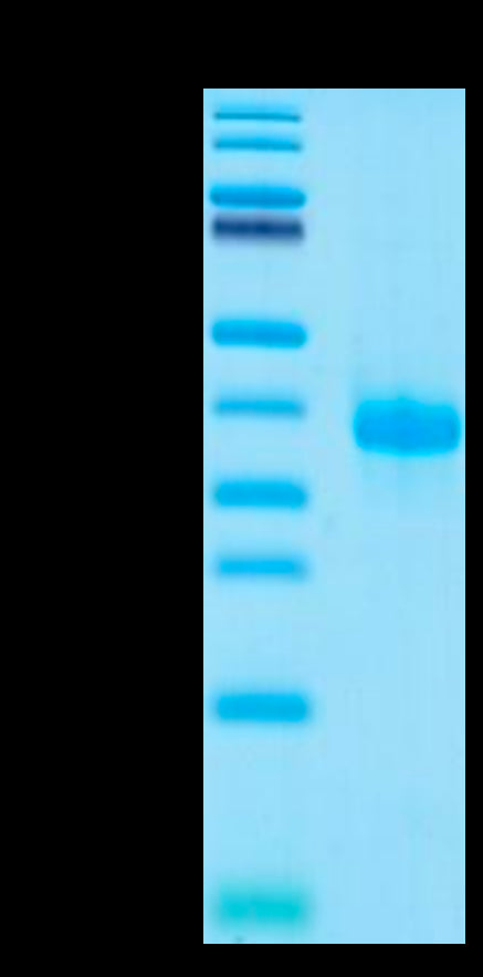 Human IGFBP-7 on Tris-Bis PAGE under reduced condition. The purity is greater than 95%.Recombinant Human IGFBP-7 Protein, Active