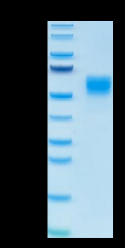 Human IL-13 on Tris-Bis PAGE under reduced condition. The purity is greater than 95%.Recombinant Human IL-13 Protein, Active