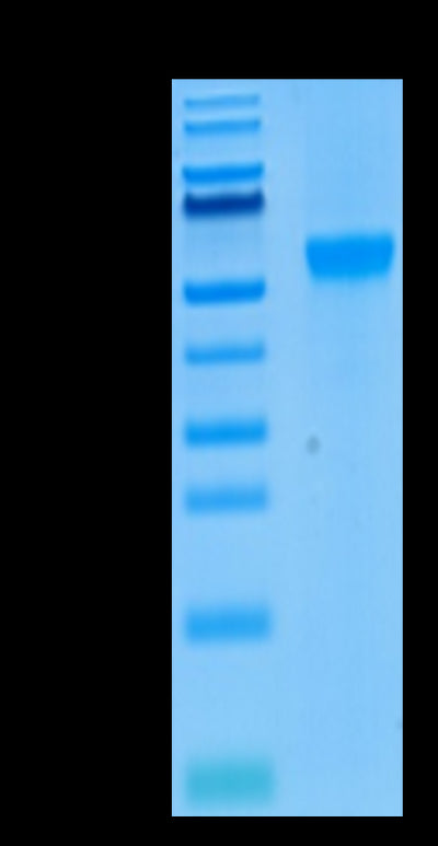 Human Siglec-8 on Tris-Bis PAGE under reduced conditions. The purity is greater than 95%.Recombinant Human Siglec-8 Protein