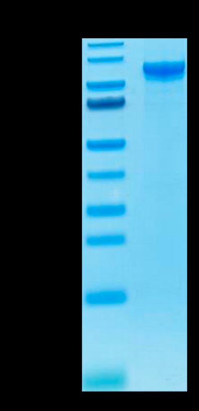 Human ENPP-2 on Tris-Bis PAGE under reduced condition. The purity is greater than 95%.Recombinant Human ENPP-2/Autotaxin Protein