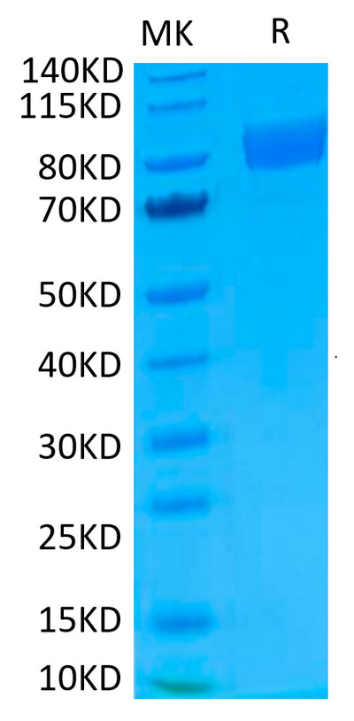 Biotinylated Human IL-17R alpha on Tris-Bis PAGE under reduced condition. The purity is greater than 95%.Biotinylated Human IL-17R alpha/CD217 Protein, Active