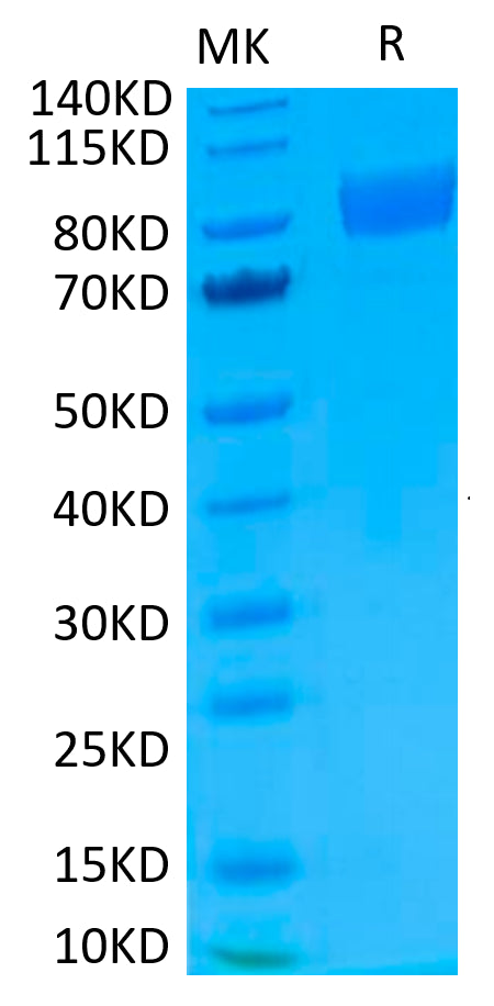 Biotinylated Human IL-17R alpha on Tris-Bis PAGE under reduced condition. The purity is greater than 95%.Biotinylated Human IL-17R alpha/CD217 Protein, Active