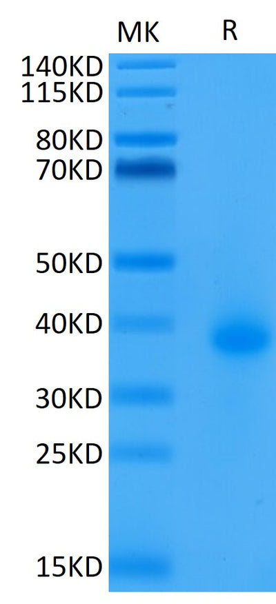 Biotinylated Human CD40 on Tris-Bis PAGE under reduced condition. The purity is greater than 95%.Biotinylated Human CD40/TNFRSF5 Protein, Active
