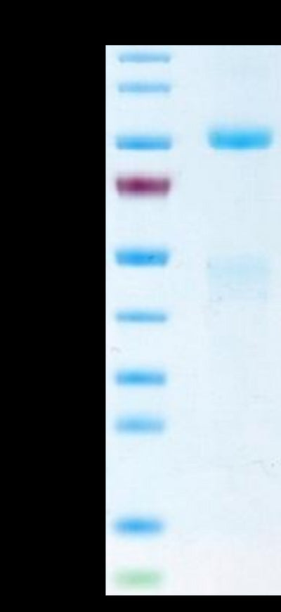 Biotinylated Human HGF R on Tris-Bis PAGE under reduced condition. The purity is greater than 95%.Biotinylated Human HGF R/c-MET Protein, Active