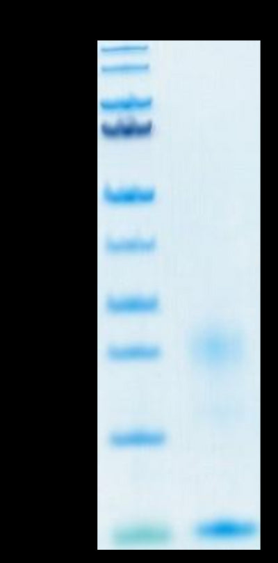 Human TSLP on Tris-Bis PAGE under reduced condition. The purity is greater than 95%.Recombinant Human TSLP Protein, Active