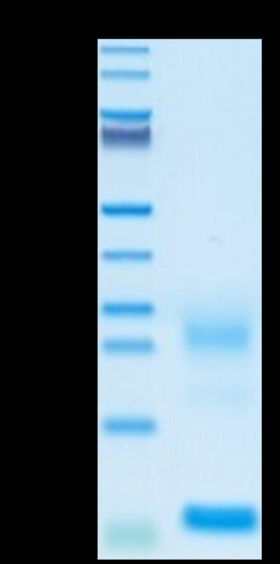 Biotinylated Human TSLP on Tris-Bis PAGE under reduced conditions. The purity is greater than 95%.Biotinylated Human TSLP Protein, Active