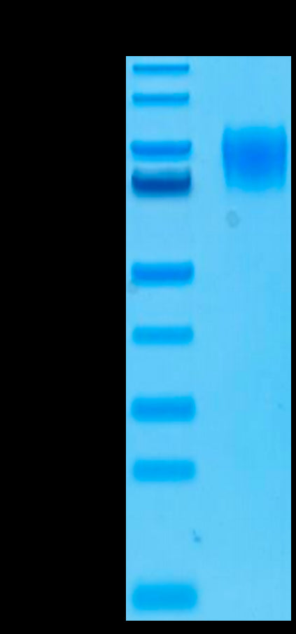 Biotinylated Human IFNAR1 on Tris-Bis PAGE under reduced conditions. The purity is greater than 95%.Biotinylated Human IFN alpha/beta R1 Protein, Active