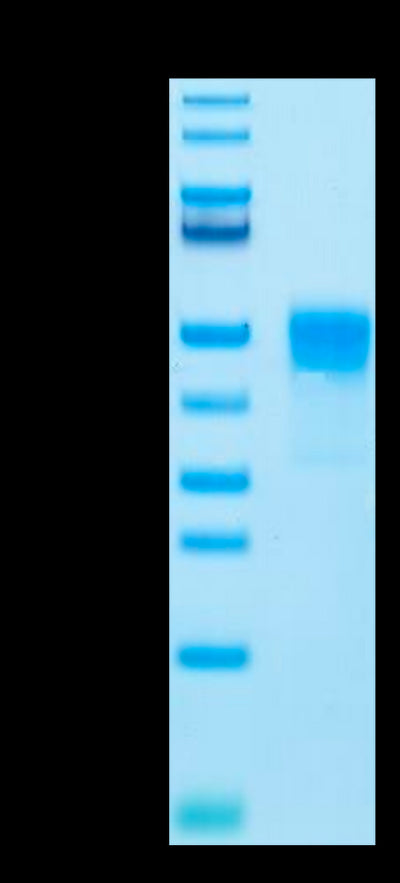 Rat TROP-2 on Tris-Bis PAGE under reduced condition. The purity is greater than 95%.Recombinant Rat TROP-2/TACSTD2 Protein