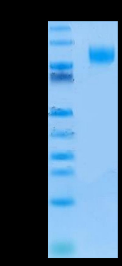 Human IL-13Ra1 on Tris-Bis PAGE under reduced conditions. The purity is greater than 95%.Recombinant Human IL-13Ra1 Protein, Active