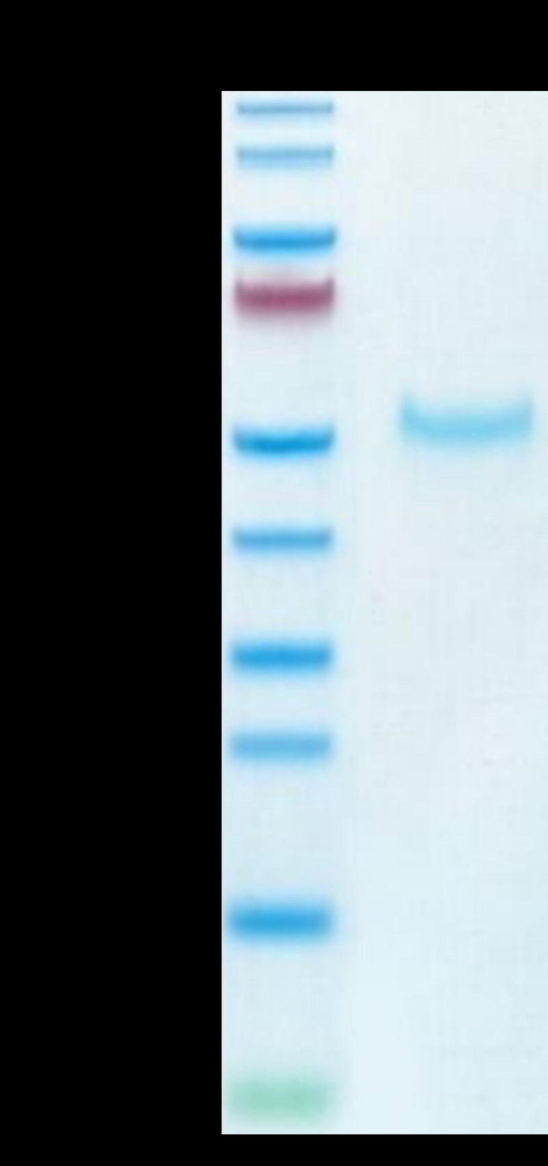Cynomolgus PVRIG on Tris-Bis PAGE under reduced condition. The purity is greater than 95%.Recombinant Cynomolgus PVRIG Protein, Active