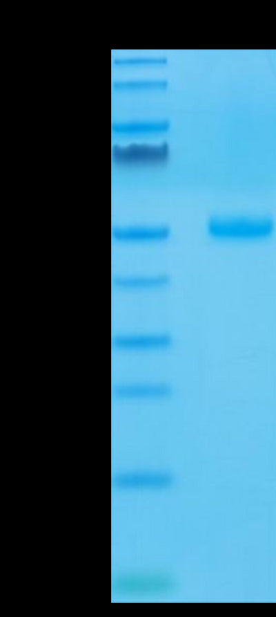 Human CTLA-4 on Tris-Bis PAGE under reduced condition. The purity is greater than 95%.Recombinant Human CTLA-4/CD152 Protein, Active
