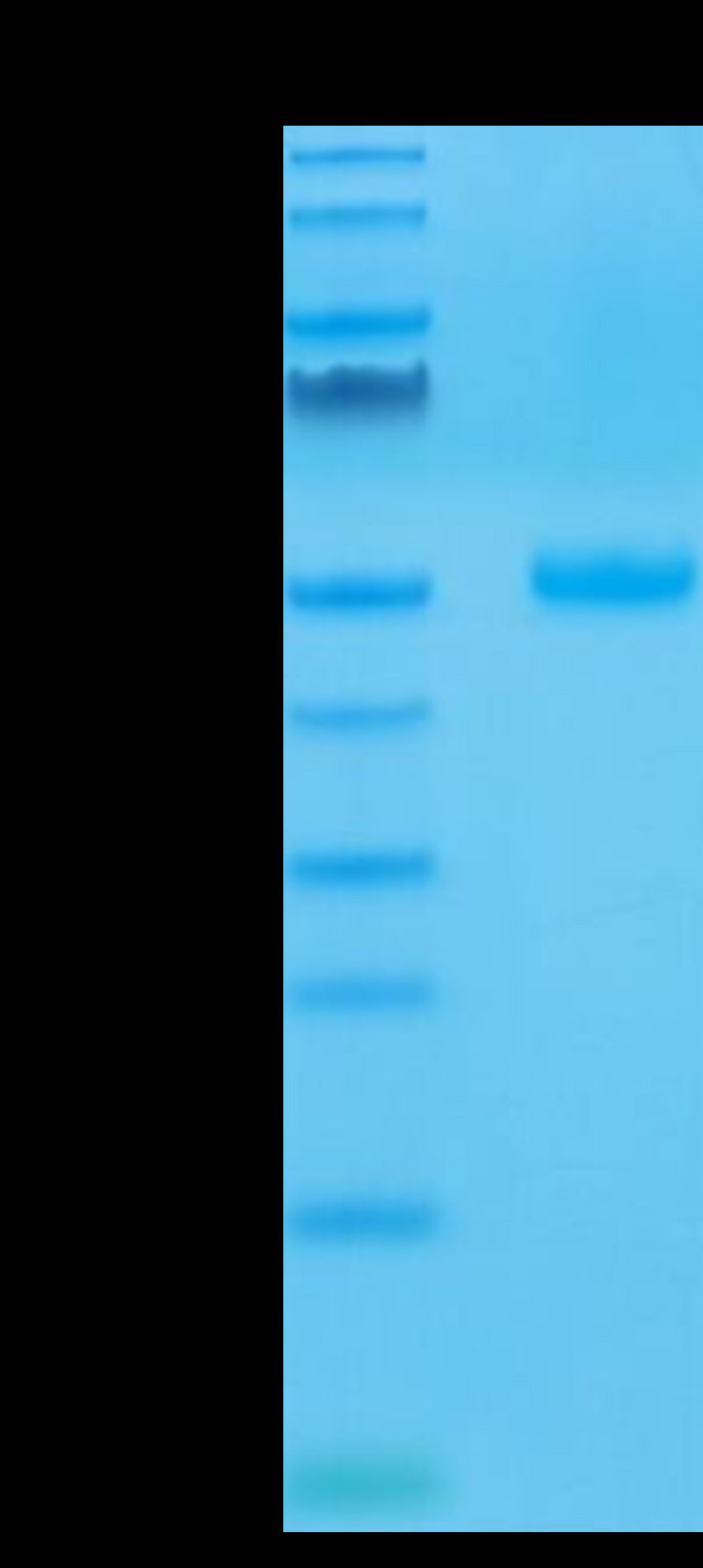Human CTLA-4 on Tris-Bis PAGE under reduced condition. The purity is greater than 95%.Recombinant Human CTLA-4/CD152 Protein, Active