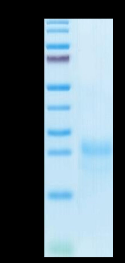 Cynomolgus CTLA-4 on Tris-Bis PAGE under reduced condition. The purity is greater than 95%.Recombinant Cynomolgus CTLA-4/CD152 Protein, Active