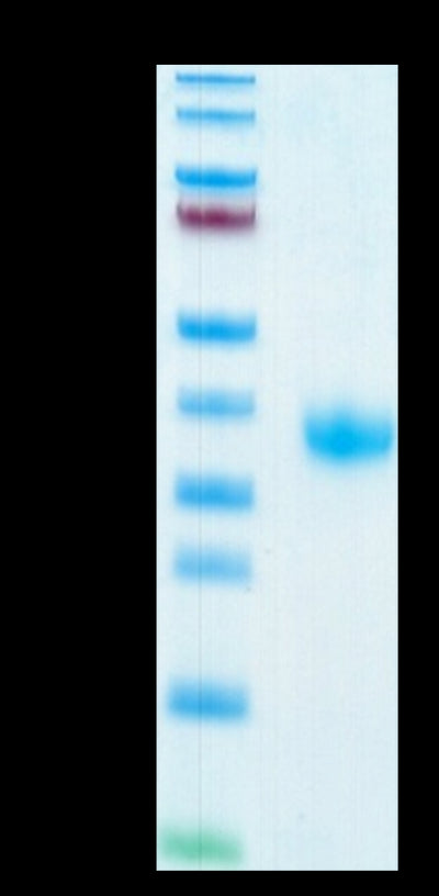 SARS-COV-2 Spike RBD on Tris-Bis PAGE under reduced condition. The purity is greater than 95%.Recombinant SARS-COV-2 Spike RBD Protein, Active
