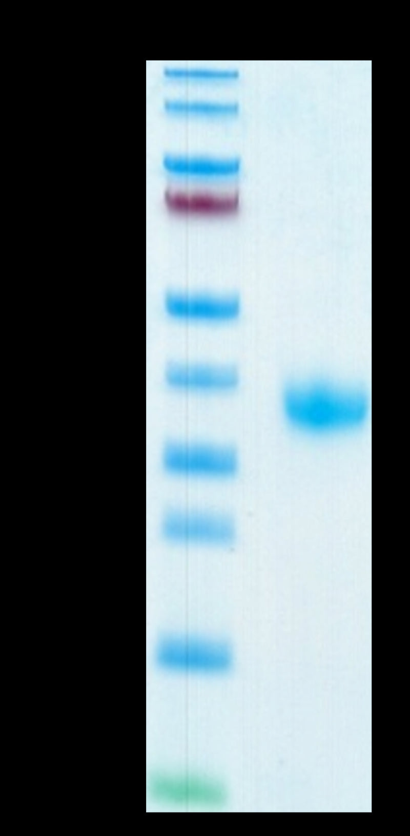 SARS-COV-2 Spike RBD on Tris-Bis PAGE under reduced condition. The purity is greater than 95%.Recombinant SARS-COV-2 Spike RBD Protein, Active