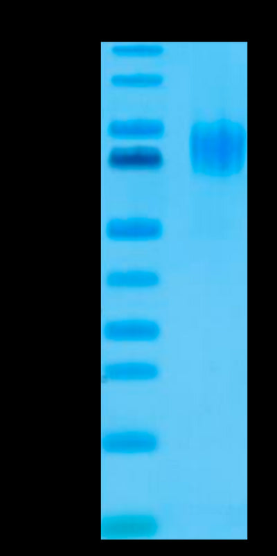 Human EGFRVIII on Tris-Bis PAGE under reduced condition. The purity is greater than 95%.Recombinant Human EGFRVIII Protein, Active