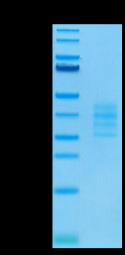Biotunylated Human BCMA Trimer on Tris-Bis PAGE under reduced condition. The purity is greater than 95%.