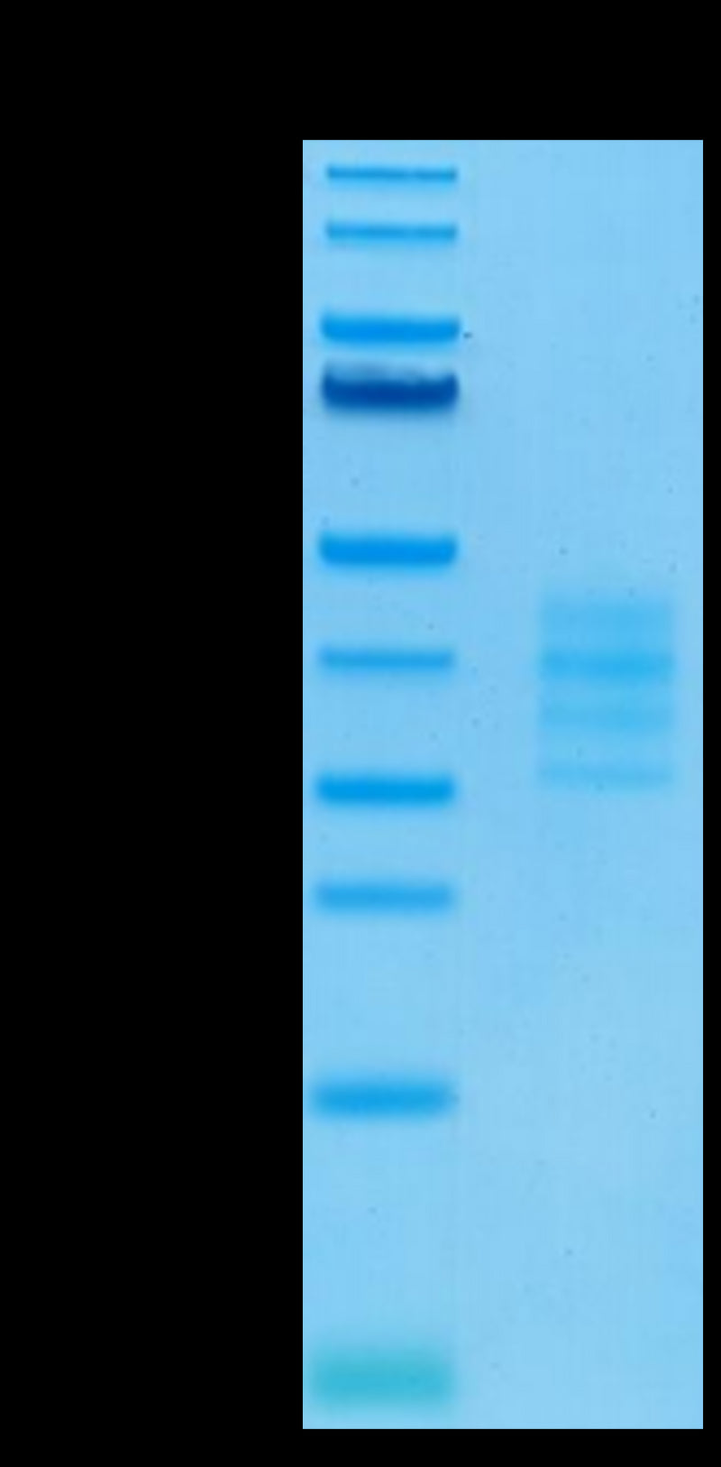 Biotunylated Human BCMA Trimer on Tris-Bis PAGE under reduced condition. The purity is greater than 95%.Biotinylated Human BCMA/TNFRSF17 Trimer Protein, Active