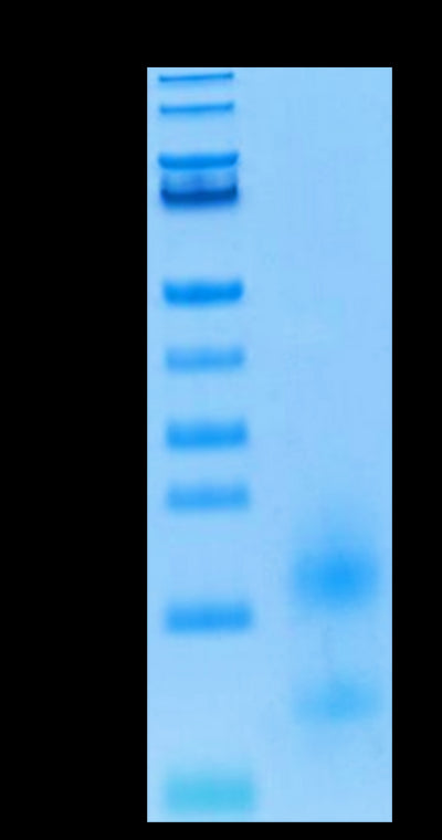 Biotinylated Human BCMA on Tris-Bis PAGE under reduced condition. The purity is greater than 95%.