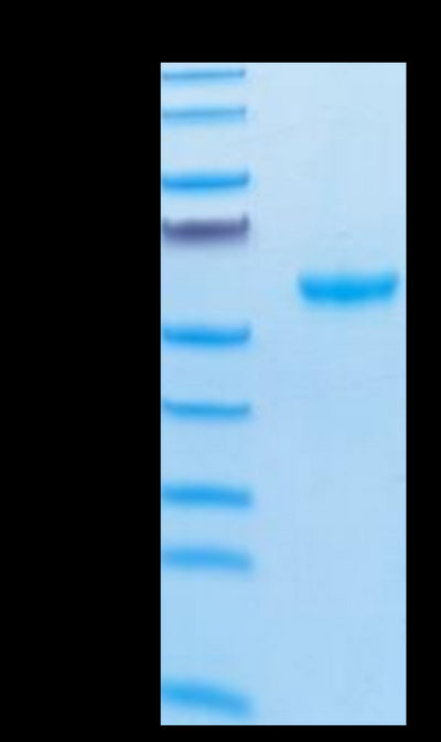 Cynomolgus APRIL Trimer on Tris-Bis PAGE under reduced condition. The purity is greater than 95%.Recombinant Cynomolgus APRIL/TNFSF13 Trimer Protein, Active
