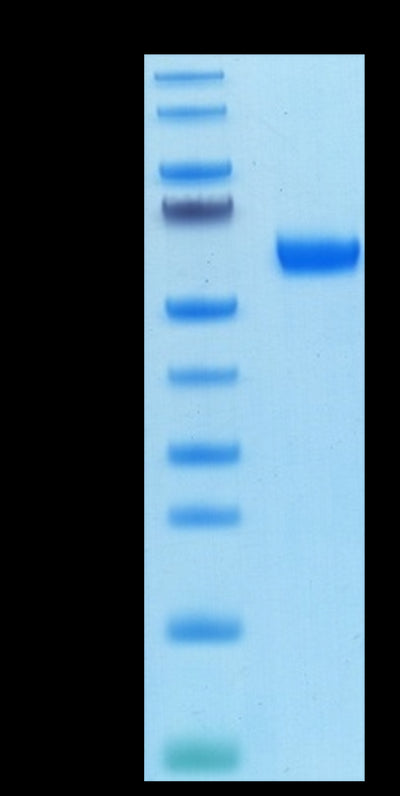 Biotinylated Cynomolgus APRIL Trimer on Bis-Tris PAGE under reduced condition. The purity is greater than 95%.Biotinylated Cynomolgus APRIL/TNFSF13 Trimer Protein, Endotoxin-Free, Active