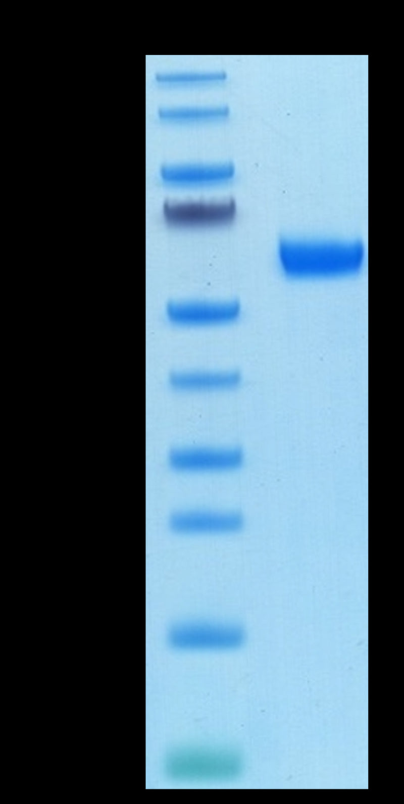 Biotinylated Cynomolgus APRIL Trimer on Bis-Tris PAGE under reduced condition. The purity is greater than 95%.Biotinylated Cynomolgus APRIL/TNFSF13 Trimer Protein, Endotoxin-Free, Active