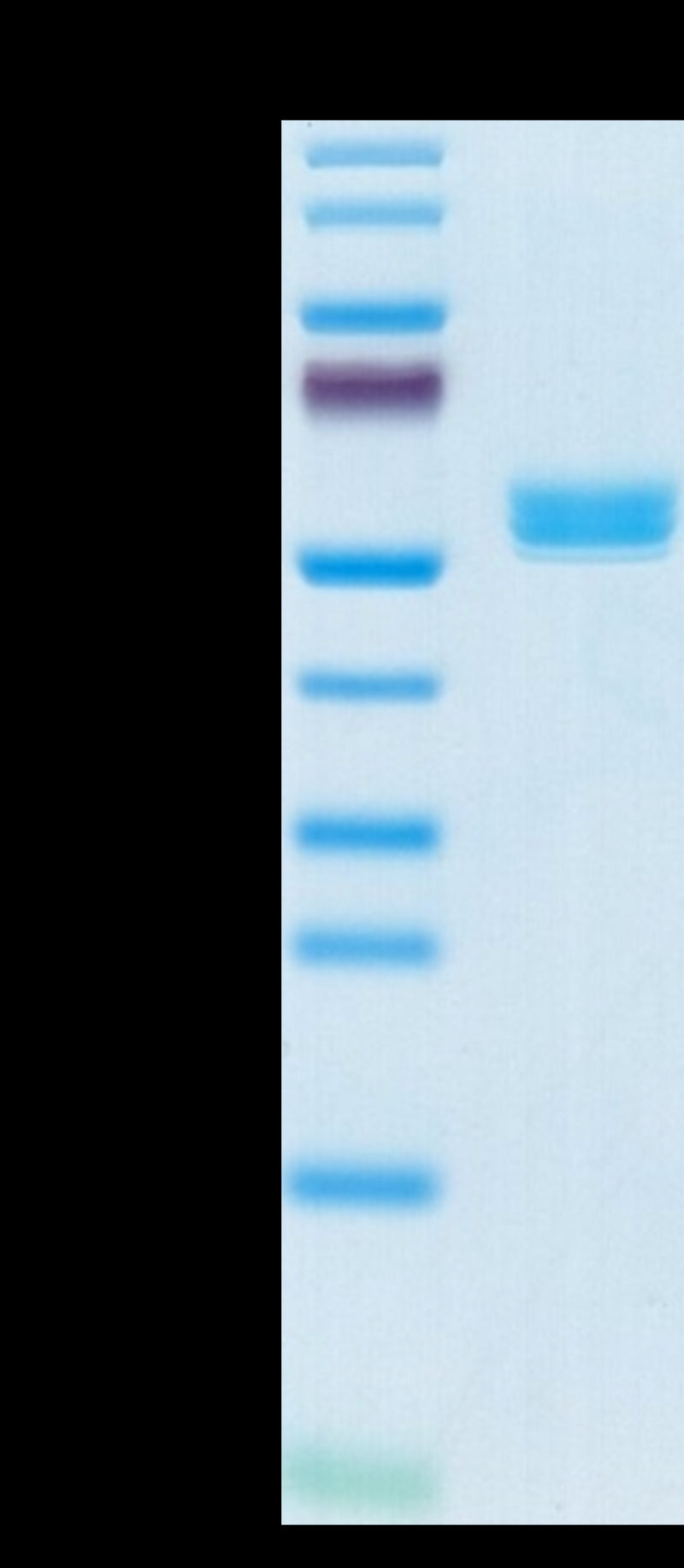 Biotinylated Cynomolgus BAFF Trimer on Tris-Bis PAGE under reduced condition. The purity is greater than 95%.Biotinylated Cynomolgus BAFF/TNFSF13B/CD257 Trimer Protein, Active