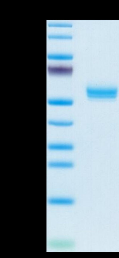 Cynomolgus BAFF Trimer on Tris-Bis PAGE under reduced condition. The purity is greater than 95%.Recombinant Cynomolgus BAFF/TNFSF13B/CD257 Trimer Protein, Active