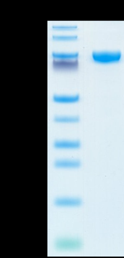 Human IL-18RAP on Tris-Bis PAGE under reduced condition. The purity is greater than 95%.Recombinant Human IL-18RAP Protein, Active