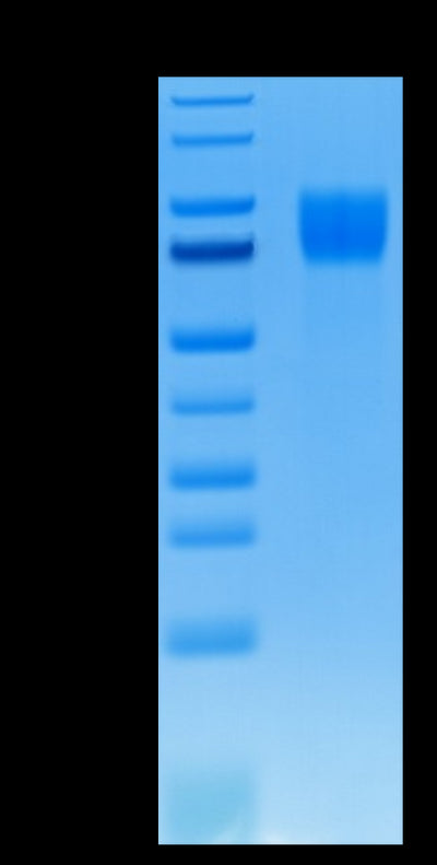 Human FGFR1 alpha (IIIc) on Tris-Bis PAGE under reduced conditions. The purity is greater than 95%.Recombinant Human FGFR1 alpha (IIIc) Protein, Active