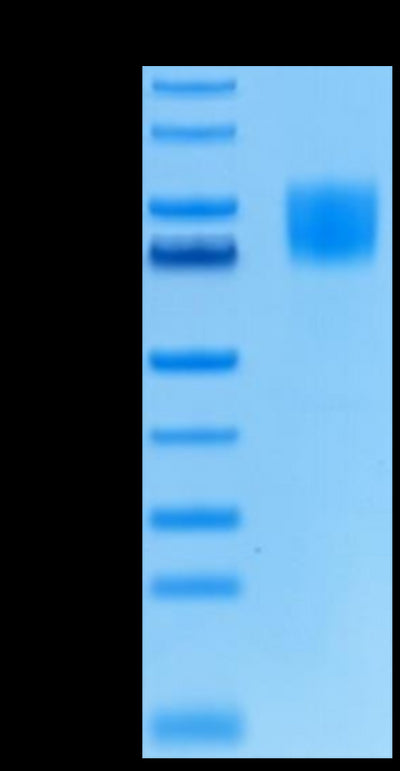 Biotinylated Human FGFR1 alpha (IIIc) -on Tris-Bis PAGE under reduced condition. The purity is greater than 95%.Biotinylated Human FGFR1 alpha (IIIc) Protein, Active