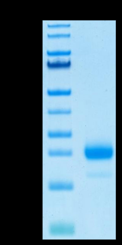 Human IL-4 on Tris-Bis PAGE under reduced condition. The purity is greater than 95%.Recombinant Human IL-4 Protein, Active