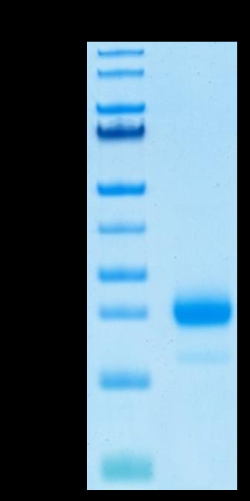 Human IL-4 on Tris-Bis PAGE under reduced condition. The purity is greater than 95%.Recombinant Human IL-4 Protein, Active