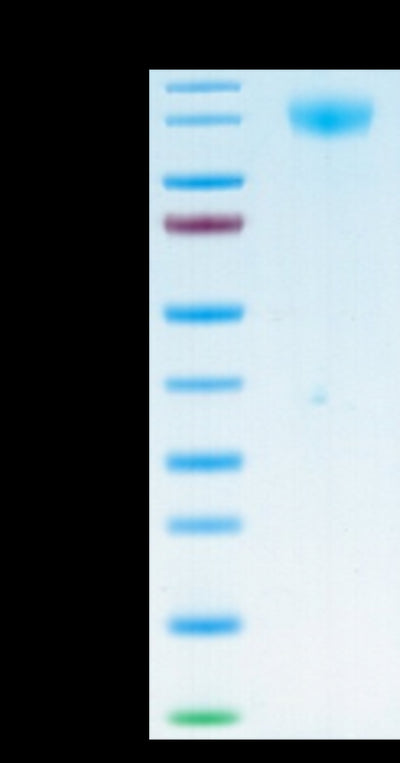Biotinylated SARS-COV-2 Spike S1 on Tris-Bis PAGE under reduced condition. The purity is greater than 95%.Biotinylated SARS-COV-2 Spike S1 Protein, Active