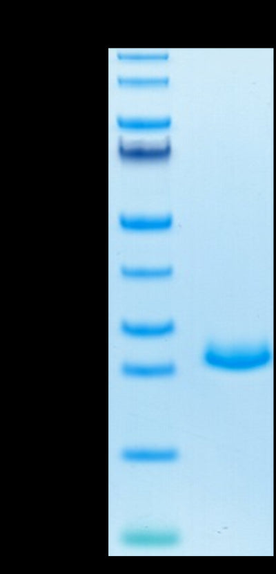 Mouse FGF21 on Tris-Bis PAGE under reduced condition. The purity is greater than 95%.Recombinant Mouse FGF21 Protein, Active