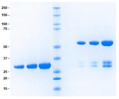 Native Human Immunoglobulin G (IgG) Protein, FC Fragment, Immunogen ...