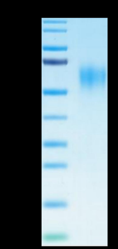 Human IL-15RA on Tris-Bis PAGE under reduced condition. The purity is greater than 95%.Recombinant Human IL-15RA/IL-15 R alpha/CD215 Protein, Active