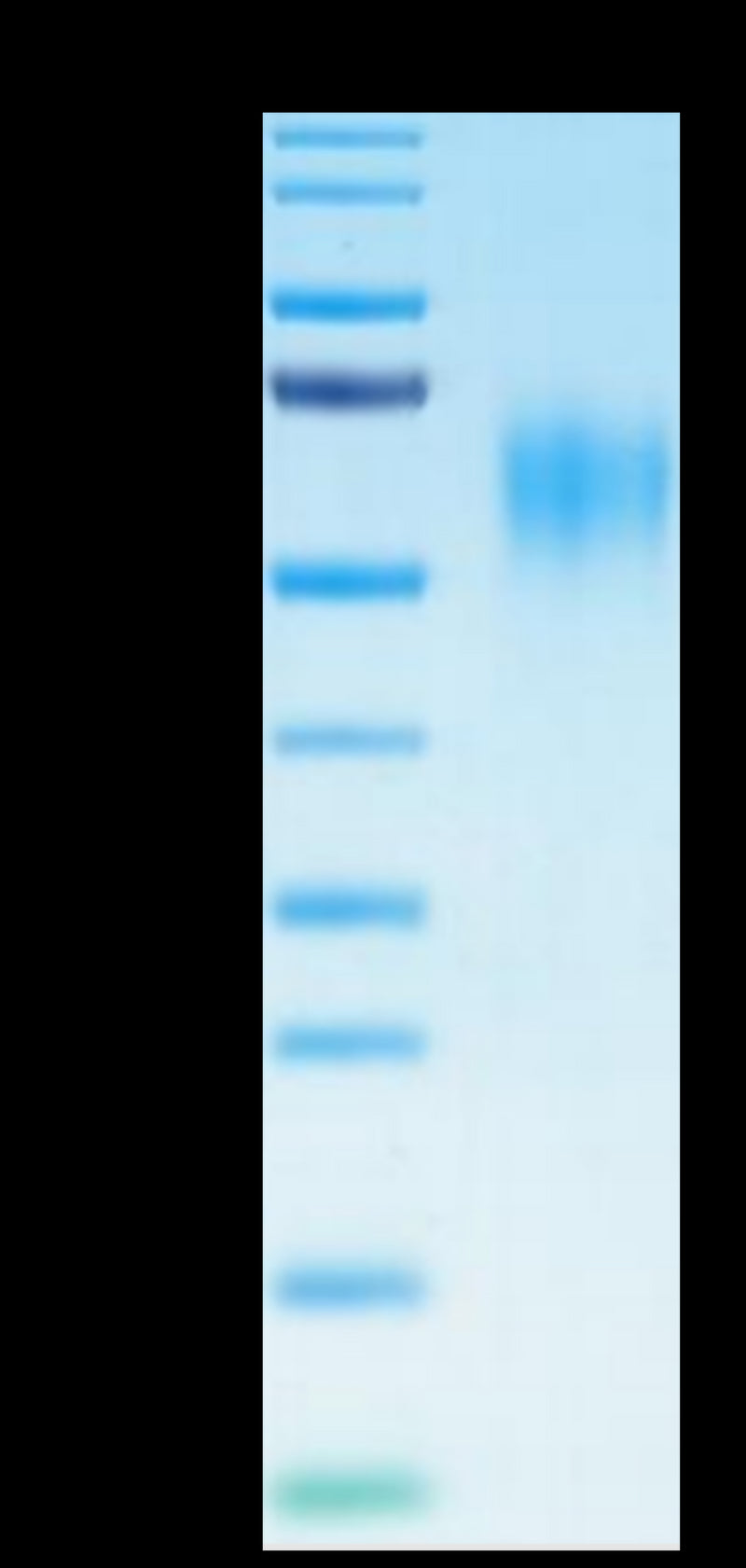 Human IL-15RA on Tris-Bis PAGE under reduced condition. The purity is greater than 95%.Recombinant Human IL-15RA/IL-15 R alpha/CD215 Protein, Active