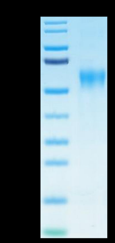 Biotinylated Human IL-15RA on Tris-Bis PAGE under reduced condition. The purity is greater than 95%.Biotinylated Human IL-15RA/IL-15 R alpha/CD215 Protein, Active