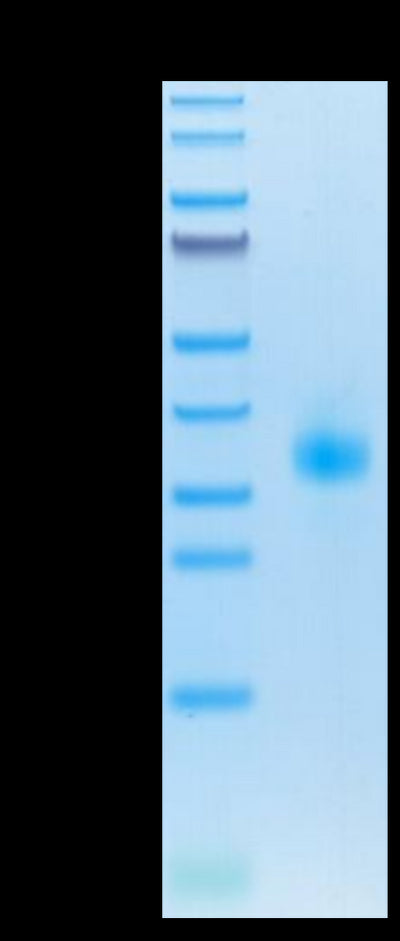 Mouse SOST on Tris-Bis PAGE under reduced condition. The purity is greater than 95%.Recombinant Mouse SOST/Sclerostin Protein