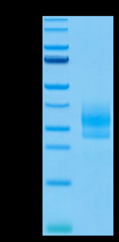 Human SOST on Tris-Bis PAGE under reduced condition. The purity is greater than 95%.Recombinant Human SOST/Sclerostin Protein, Active