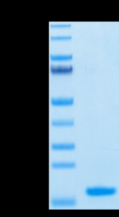 Human Nectin-4 IgV Domain on Tris-Bis PAGE under reduced condition. The purity is greater than 95%.Recombinant Human Nectin-4 Protein IgV Domain, Active