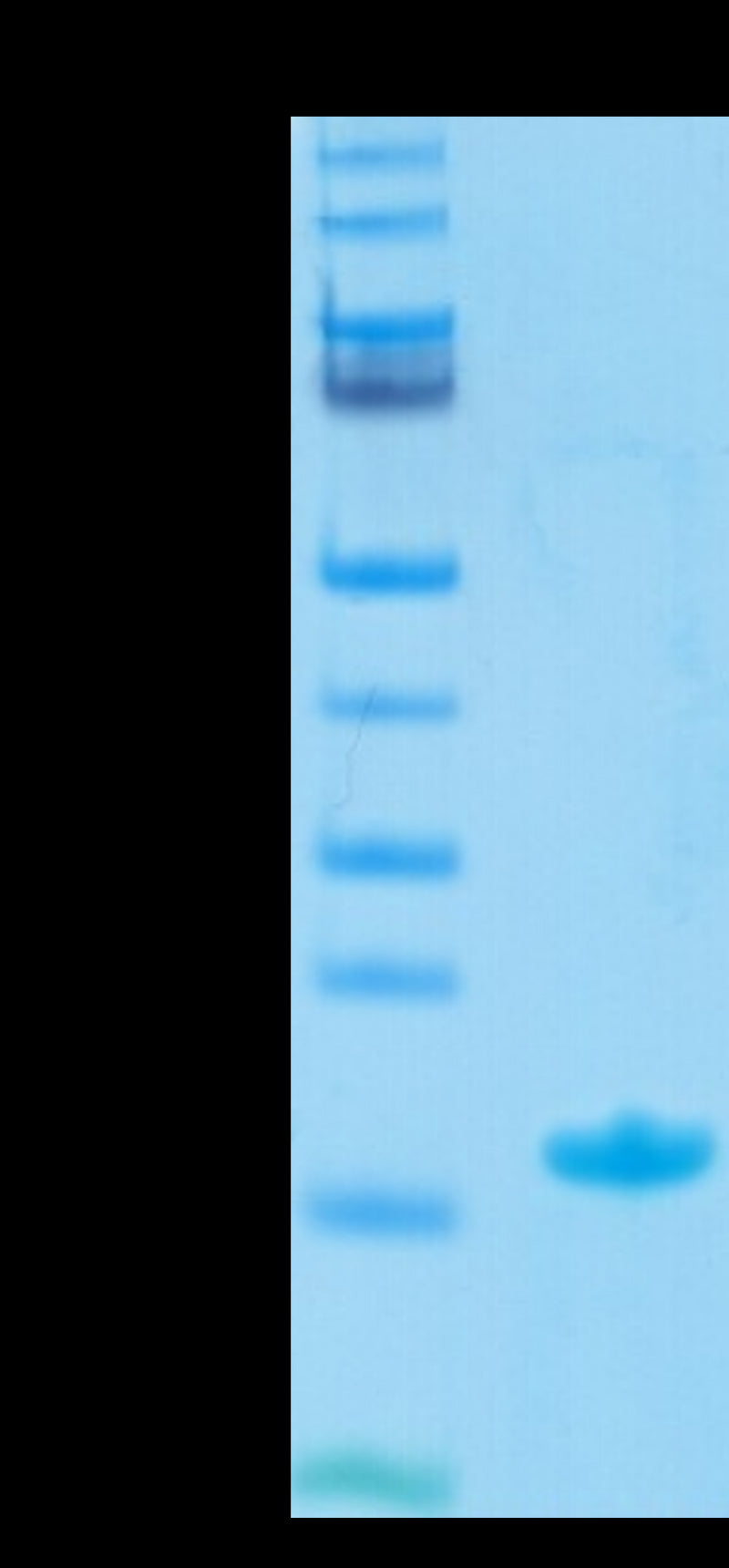 Biotinylated Human Nectin-4 IgV Domain on Tris-Bis PAGE under reduced condition. The purity is greater than 95%.Biotinylated Human Nectin-4 Protein IgV Domain, Active